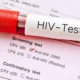 شناسایی نیمی از مبتلایان به ایدز در ایران/ درمان قطعی ایدز در راه است
